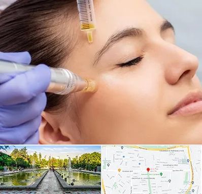 میکرونیدلینگ در سرسبز