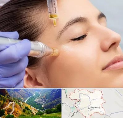 میکرونیدلینگ در کردستان