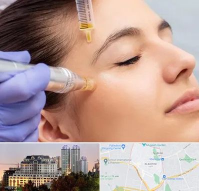 میکرونیدلینگ در فرشته