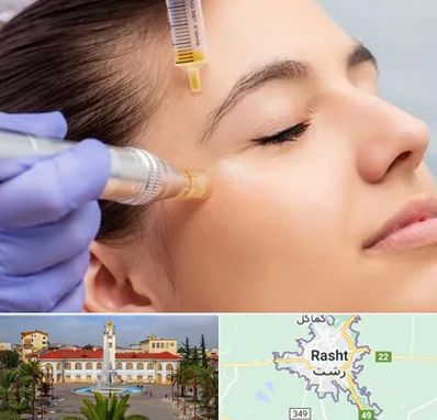 میکرونیدلینگ در رشت