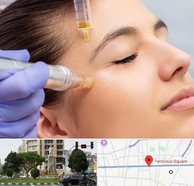 میکرونیدلینگ در میدان فردوسی تهران