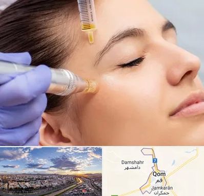 میکرونیدلینگ در قم