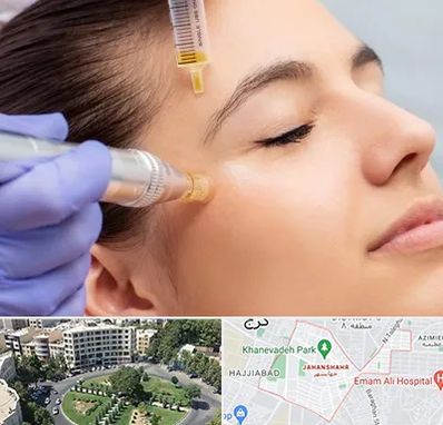 میکرونیدلینگ در جهانشهر کرج