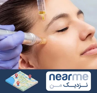 میکرونیدلینگ در نزدیک من