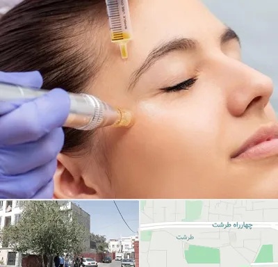 میکرونیدلینگ در طرشت
