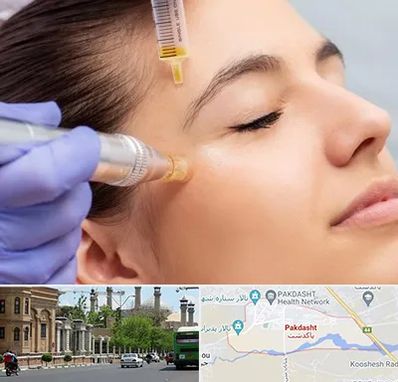 میکرونیدلینگ در پاکدشت