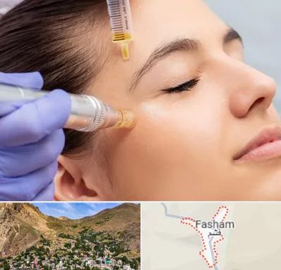 میکرونیدلینگ در فشم