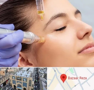 میکرونیدلینگ در بازار رضا مشهد