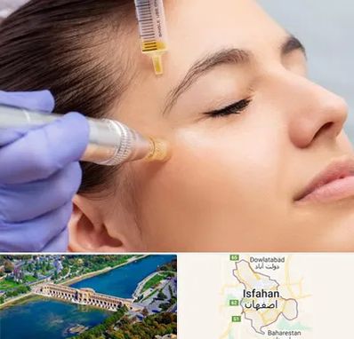 میکرونیدلینگ در اصفهان