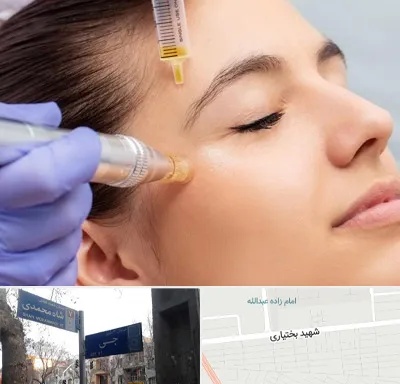 میکرونیدلینگ در سی متری جی