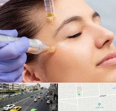 میکرونیدلینگ در خیابان دامپزشکی