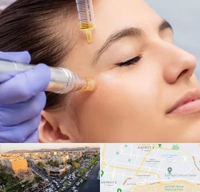 میکرونیدلینگ در تهرانپارس تهران