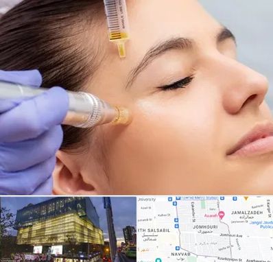 میکرونیدلینگ در جمهوری