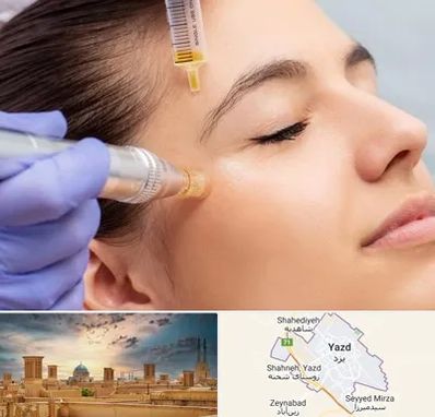 میکرونیدلینگ در یزد