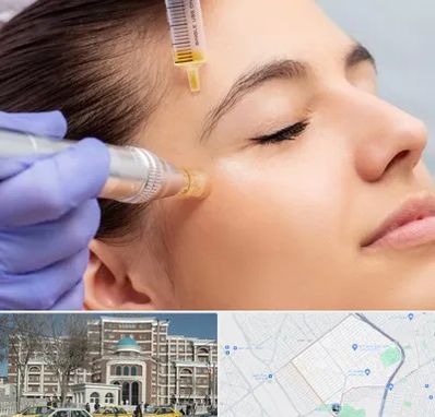 میکرونیدلینگ در طلاب مشهد