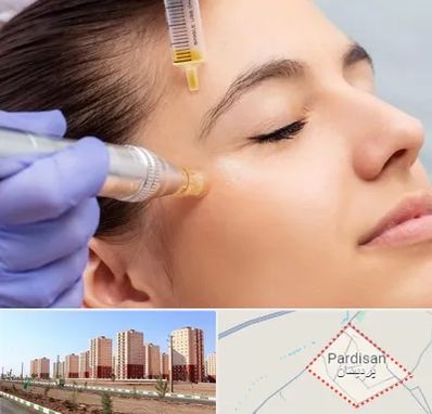 میکرونیدلینگ در پردیسان قم
