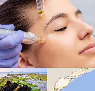 میکرونیدلینگ در بندرلنگه