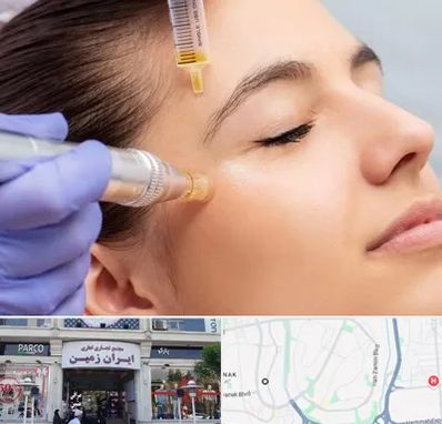 میکرونیدلینگ در ایران زمین