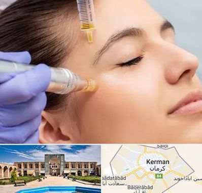 میکرونیدلینگ در کرمان