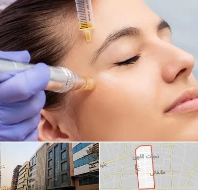 میکرونیدلینگ در نجات اللهی