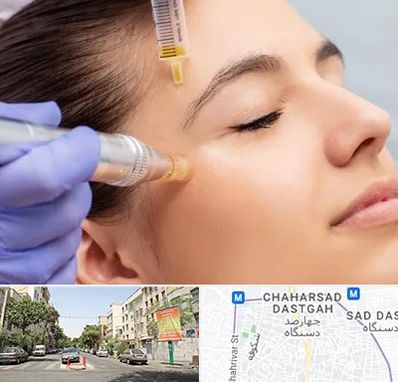 میکرونیدلینگ در چهارصد دستگاه