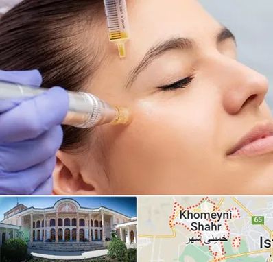 میکرونیدلینگ در خمینی شهر