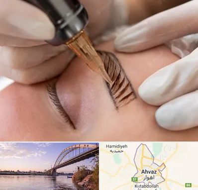 میکروبلیدینگ در اهواز