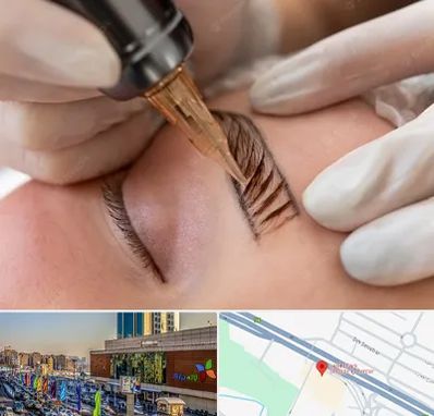 میکروبلیدینگ در لاله پارک تبریز