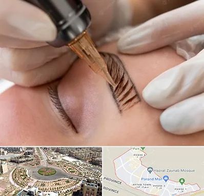 میکروبلیدینگ در پرند