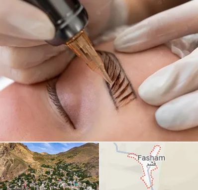 میکروبلیدینگ در فشم