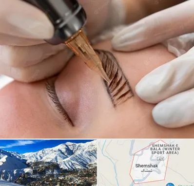 میکروبلیدینگ در شمشک