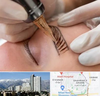 میکروبلیدینگ در شهرک غرب تهران