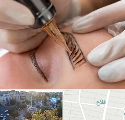 میکروبلیدینگ در فلاح