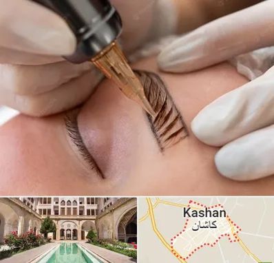 میکروبلیدینگ در کاشان