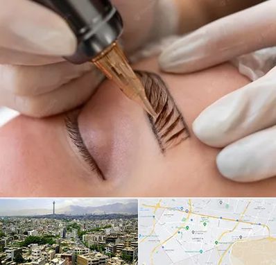 میکروبلیدینگ در منطقه 8 تهران