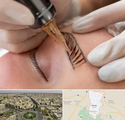 میکروبلیدینگ در قزوین