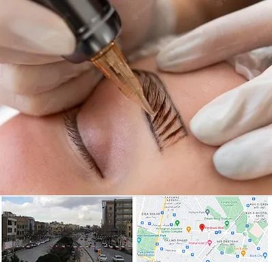 میکروبلیدینگ در بلوار فردوسی مشهد