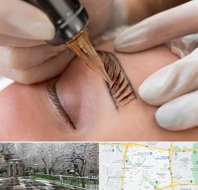 میکروبلیدینگ در باغ فیض