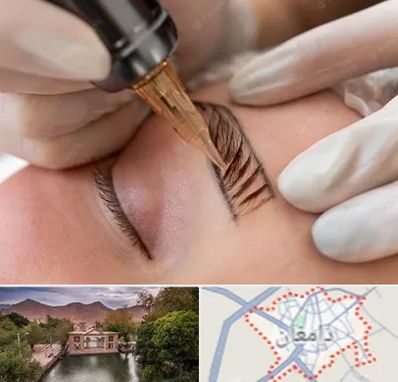 میکروبلیدینگ در دامغان