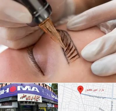 میکروبلیدینگ در امین حضور