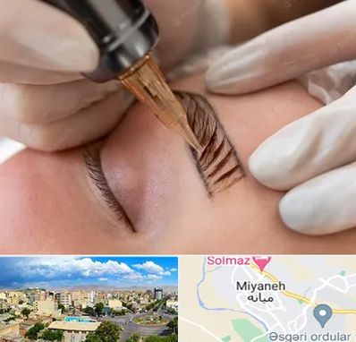 میکروبلیدینگ در میانه