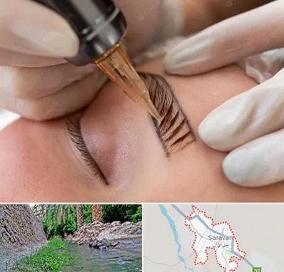 میکروبلیدینگ در سراوان