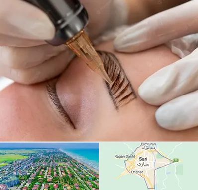 میکروبلیدینگ در ساری