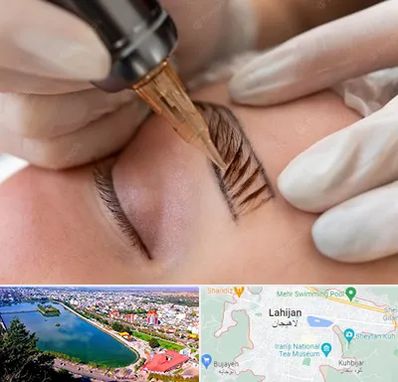 میکروبلیدینگ در لاهیجان