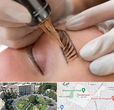 میکروبلیدینگ در جهانشهر کرج