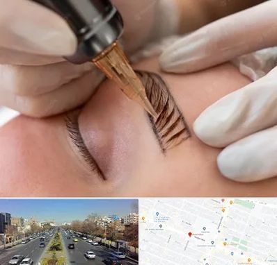 میکروبلیدینگ در بلوار معلم مشهد