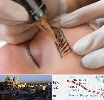 میکروبلیدینگ در فرمانیه