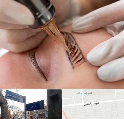 میکروبلیدینگ در سی متری جی