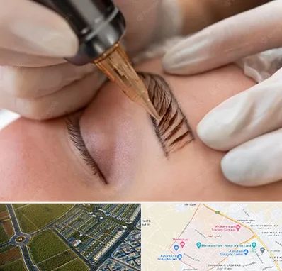 میکروبلیدینگ در الهیه مشهد