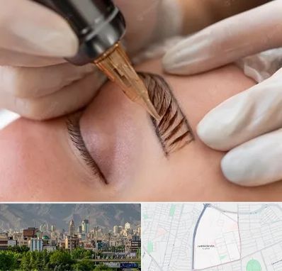 میکروبلیدینگ در جمشیدیه